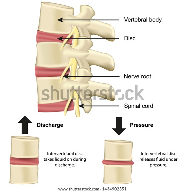 Vertebral body and disc anatomy and\
functionality on pressure medical vector illustration eps\
10