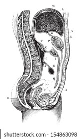 Vertical and antero-posterior of the abdomen, Path of the peritoneum in the epigastric and hypogastric regions in women, vintage engraved illustration. Usual Medicine Dictionary - Paul Labarthe - 1885