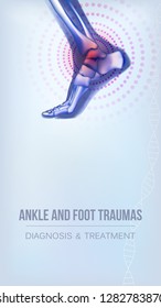 Vertical light blue banner with ankle and foot joints traumas concept. Realistic bones of foot skeleton of human leg. For advertising, medical publications in social media. Vector illustration stock.