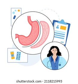 Vertical Sleeve Gastrectomy. Consultation With Doctor In Clinic. Stomach Surgery, Weight Loss Gastric Procedure. Laparoscopy Concept. Overweight Problem In Human Body. Flat Vector Medical Illustration