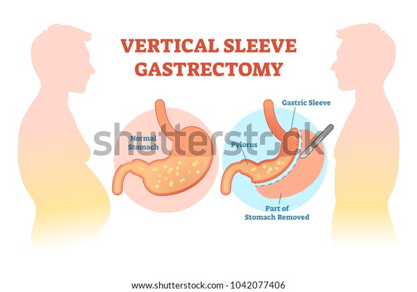 Vector De Stock Libre De Regalias Sobre Diagrama De Ilustracion Del Vector Medico