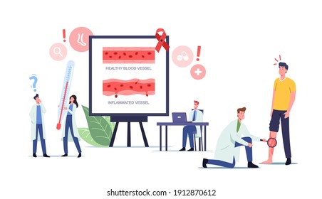 Gefäßentzündung, Rosazea Vaskulitis Behandlungskonzept. Winzige Ärzte mit riesigen medizinischen Geräten prüfen den Patienten mit Fußschwäche, Gesundheitsversorgung. Vektorgrafik von Cartoon People