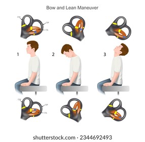 Vestibular Tests Bow and Lean Maneuver - practical guide to the treatment of benign positional paroxysmal vertigo (bppv). Training manual, education. Diagram of the structure of the inner ear. Vector