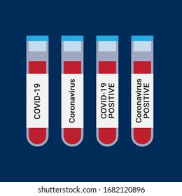 Vials of blood for COVID Coronavirus testing