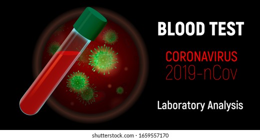 Anzeige des Virus unter dem Mikroskop. Bluttestrohr. Grippe-Ausbruch in Asien und Grippepandemie in Koronviren. Laboranalyse von Coronavirus 2019-nCov.