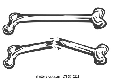 Vintage monochrome whole and broken bone isolated on white background. Hand drawn design element template for emblem, print, cover, poster. Vector illustration.