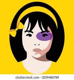 Violence Against Children -  Children Torture -  Girl With Dark Hair And Yellow Bow With Purple Spot Over Her Eye