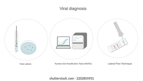 Die Viruserkennung und -identifizierung oder die infektiöse Diagnose, die die Testmethode darstellt: Virale Kultur, NAATs wie PCR oder qPCR und Lateralfluss oder Schnelltest