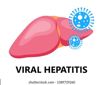Viral hepatitis A, B, C, D is symbol, cirrhosis icon. World hepatitis day illustration. Liver with virus attack. Flat design vector for website and mobile website development, apps are presented.