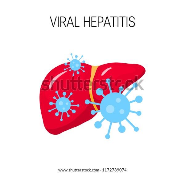 ウイルス性肝炎のコンセプト 不健康な肝臓の平らなイラスト のベクター画像素材 ロイヤリティフリー