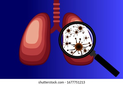 Virus y bacterias infectaron los pulmones humanos. enfermedad pulmonar, el amplificador detecta el virus pulmonar, fondo azul aislado - Vector