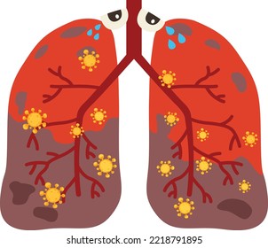 Virus or bacterial infects lungs.virus invades lungs.