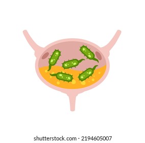 Virus In The Bladder. Infection And Inflammation Of Urine And Internal Organ. Medical Problem And Illustration. Green Virus And Bacteria.