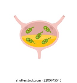 Virus In The Bladder. Infection And Inflammation Of Urine And Internal Organ. Medical Problem And Illustration. Green Virus And Bacteria.