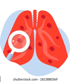 Virus cells in Infected lungs. Coronavirus, COVID-19. Disease, pneumonia, asthma, cancer, tuberculosis. Human lungs with virus under microscope, magnifier. Lung inspection concept icon. 