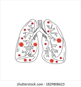Virus cells in lung. Infected lungs. Coronavirus, COVID-19. 2019-nCoV. lung disease, pneumonia.

