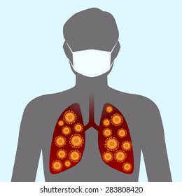 Virus and face mask, image illustration
