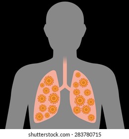 Virus in lung, image illustration