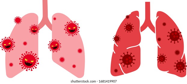 Virus and lungs illustration set