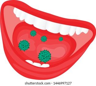 Viruses bacterial overgrowth in a mouth.  flu, cold, contageous diseas vector illustration on a white background