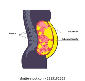 Visceral fat medical poster. Belly fat surrounds internal organs in abdominal cavity. Overweight disease concept. Losing weight, liposuction and diet. Obesity human silhouette flat vector illustration