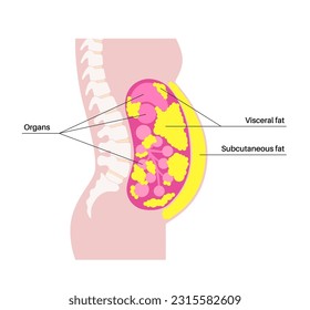 Visceral fat medical poster. Belly fat surrounds internal organs in abdominal cavity. Overweight disease concept. Losing weight, liposuction and diet. Obesity human silhouette flat vector illustration