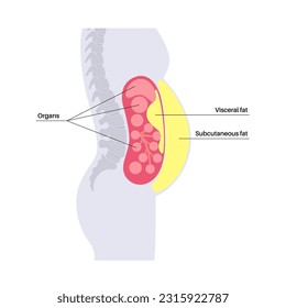 Afiche médico de grasa visceral. Las grasas del vientre rodean los órganos internos en la cavidad abdominal. Concepto de enfermedad por sobrepeso. Pérdida de peso, liposucción y dieta. Obesidad de la silueta humana ilustración vectorial plana