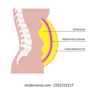 Afiche médico de grasa visceral. Las grasas del vientre rodean los órganos internos en la cavidad abdominal. Concepto de enfermedad por sobrepeso. Pérdida de peso, liposucción y dieta. Obesidad de la silueta humana ilustración vectorial plana