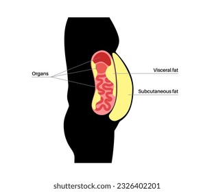 Afiche médico de grasa visceral. Las grasas del vientre rodean los órganos internos en la cavidad abdominal. Concepto de enfermedad por sobrepeso. Pérdida de peso, liposucción y dieta. Obesidad de la silueta humana ilustración vectorial plana