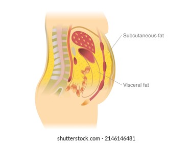 Visceral fat and subcutaneous fat accumulate around the waistline. Medical and health diagram about belly fat.