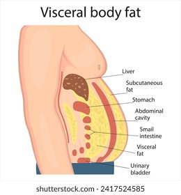 Visceral fat and subcutaneous fat accumulate around organs. Medicine and health diagram about belly fat.