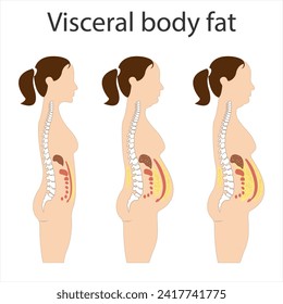 Visceral fat and subcutaneous fat accumulate around organs. Medicine and health diagram about belly fat.