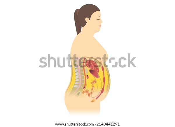 Visceral Fat Subcutaneous Fat Accumulate Around Stock Vector (Royalty ...