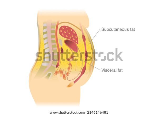 Visceral fat and\
subcutaneous fat accumulate around the waistline. Medical and\
health diagram about belly\
fat.