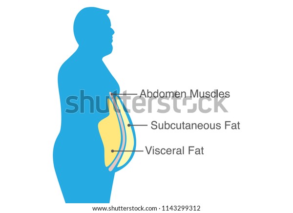 Visceral Fat Subcutaneous Fat That Accumulate Stock Vector (Royalty ...