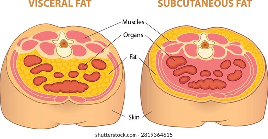 Visceral Fat vs Subcutaneous Fat Comparison Cross-Section - vector