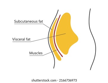 Visceral and subcutaneous fat around waistline. Location of visceral fat in abdominal cavity. Types of human obesity. Medical scheme. Vector illustration isolated on white background.