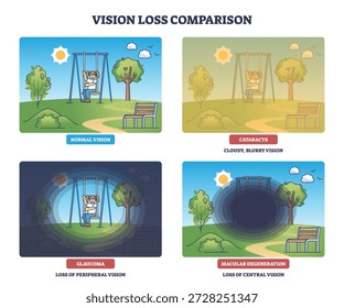 El diagrama de pérdida de visión compara la vista normal, cataratas, glaucoma, degeneración macular utilizando una escena de patio de recreo con columpio, árboles, banco. Esquema del diagrama