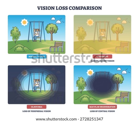 Vision loss diagram compares normal sight, cataracts, glaucoma, macular degeneration using a playground scene with swing, trees, bench. Outline diagram