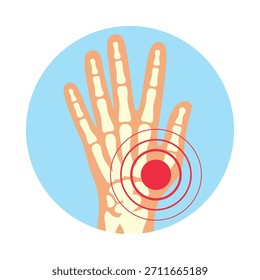 Visual representation of rheumatoid polyarthritis affecting hands with focus on pain in the joint area in a simple vector style