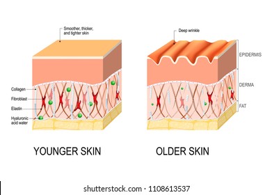 Visual representation of skin changes over a lifetime. Collagen and elastin form the structure of the dermis making it tight and plump. Fibroblasts synthesize collagen and elastin