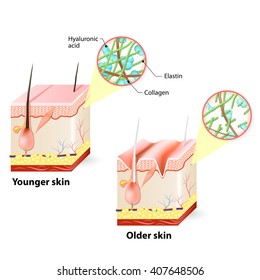 Visual representation of skin changes over a lifetime.