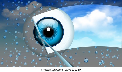 Visual therapy. The human eye with a blue iris, against a blue sky, behind glass with raindrops and wipers that cleanse vision problems. Medical Banner. Vector illustration