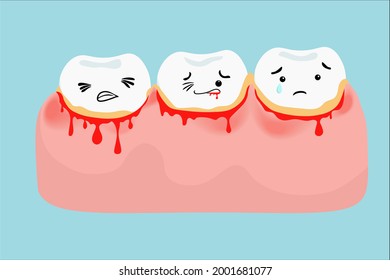 Visualization of bleeding around the teeth and plaque formation , 3 dirty teeth samples , editable vector illustration