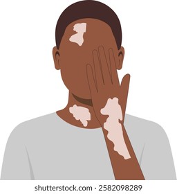 Vitiligo Awareness Vector Illustration of a Confident Person