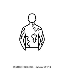 Vitiligo black line icon. Autoimmune diseases. Pictogram for web page, mobile app, promo.