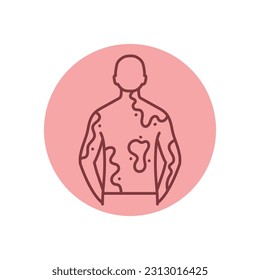 Vitiligo black line icon. Autoimmune diseases. Pictogram for web page, mobile app, promo.