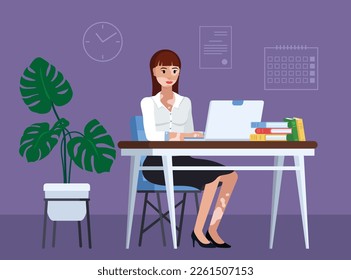 Vitiligo European Young Woman in Black and White Suit sitting at desk using laptop. Office Girl in formal wear with chronic vitiligo skin disease, fringe hair. Diversity, Body positive, inclusiveness