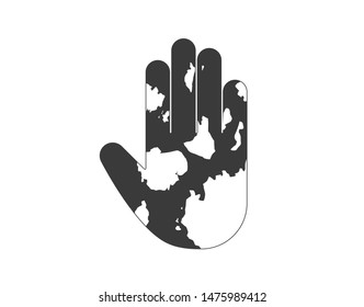 Vitiligo icon. vitiligo hand icon.  Hand irritation vector illustration. 