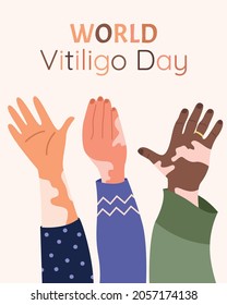 Vitiligo on the hands. Flat vector illustration. Postcard, poster, World Vitiligo Day